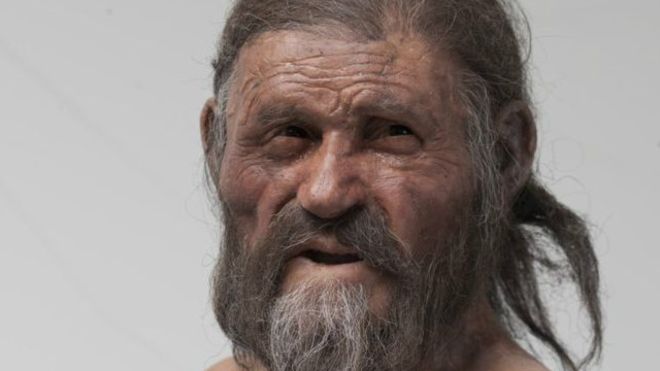 De acordo com os cientistas, Ötzi o Homem de Gelo sofria de infeção bacteriana ainda presente nos dias de hoje