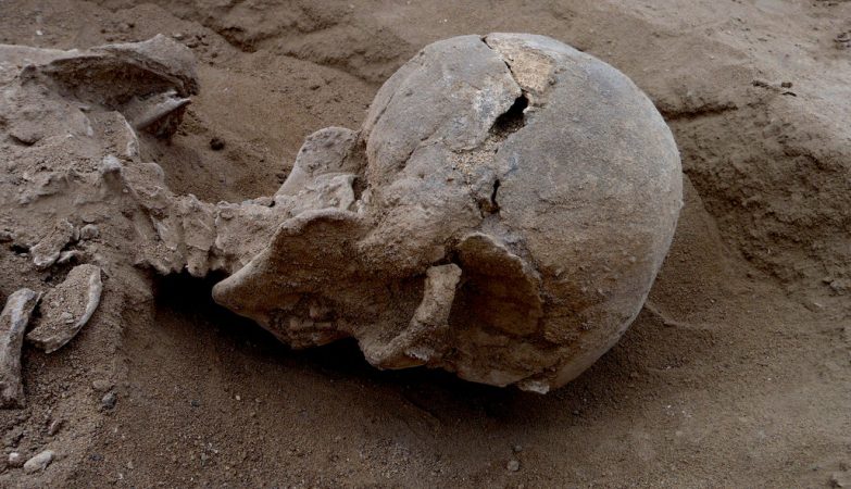 O esqueleto com 10.000 anos de um dos homens encontrados na costa do antigo laga Turkana, no Quénia, com sinais de um ferimento no crânio.