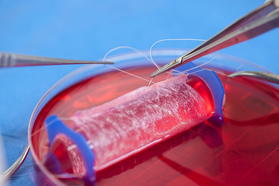 Molde da vagina implantada em laboratório