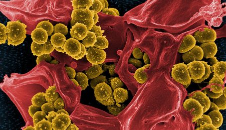 Staphylococcus aureus, uma bacteria resistente aos antibióticos