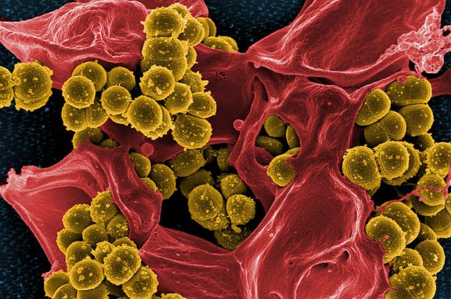 Staphylococcus aureus, uma bacteria resistente aos antibióticos