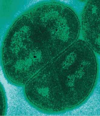 Micrografia de transmissão electrónica de um Deinococcus radiodurans, a bactéria mais resistente do Mundo