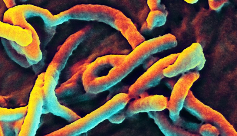 Imagem do vírus do Ébola obtida com microscopia electrónica da superfície de uma célula epitelial do fígado de um macaco africano