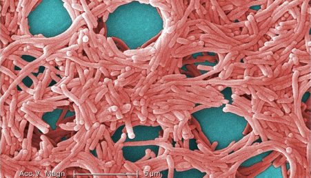 Bacterias Gram-negativas de Legionella pneumophila