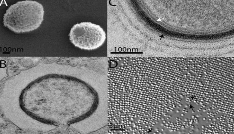 Imagens de microscopia eletrónica do Mollivirus sibericum