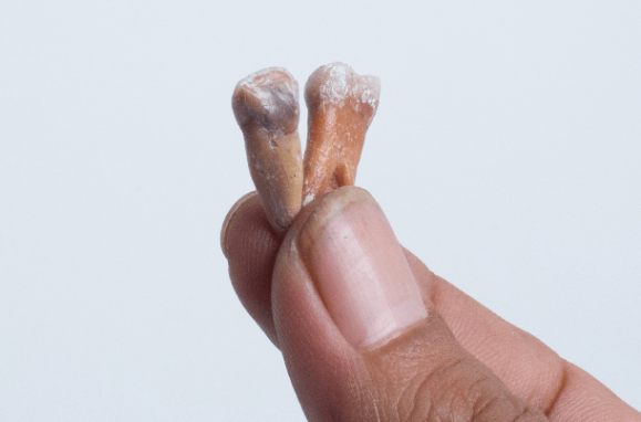 Restos fósseis de dentes do hobbit encontrados na ilha das Flores