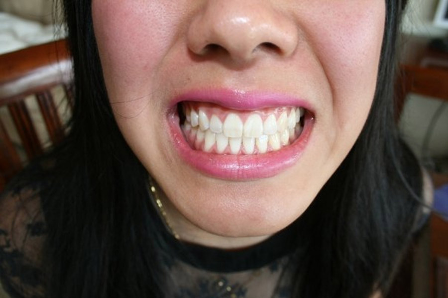 Что делают клыки зубы. Ровные зубы.