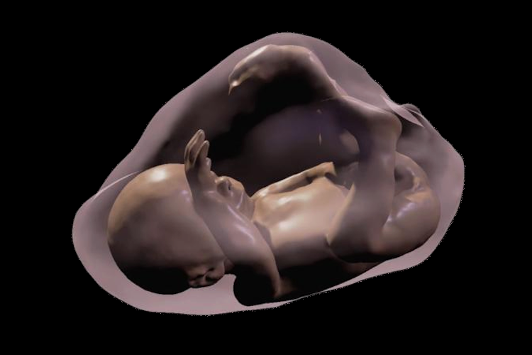 Modelo 3D de um feto com 26 semanas 