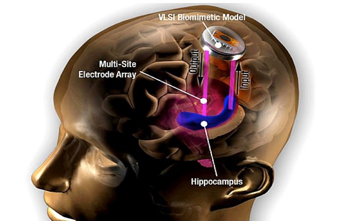 O hipocampo é uma região chave do cérebro, envolvida na formação e armazenamento da memória