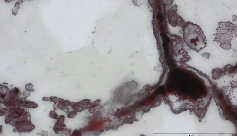 Os fósseis de minúsculos filamentos encontrados em depósitos de fontes hidrotermais no Canadá