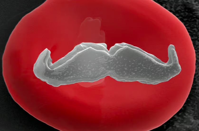 The world’s smallest mustache on a red blood cell